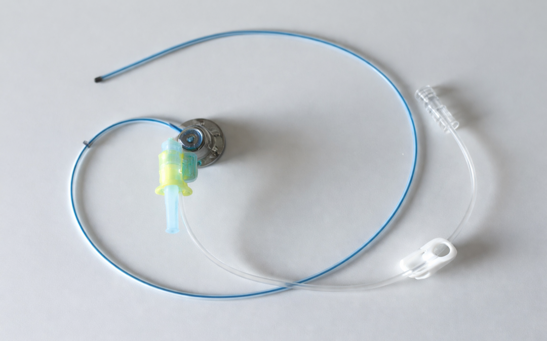 Chambre implantable (PAC) : surveillance et bonnes pratiques en perfusion à domicile
